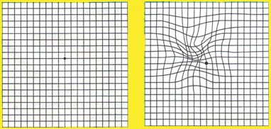 Test de vue Test de vue